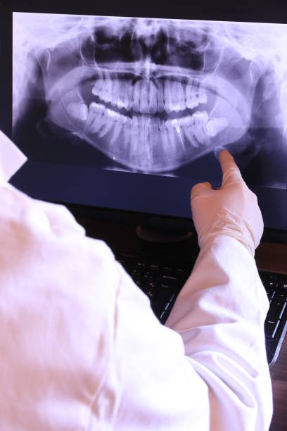 Best Emergency Dental Extractions in Lifornia Polytechnic State University, CA